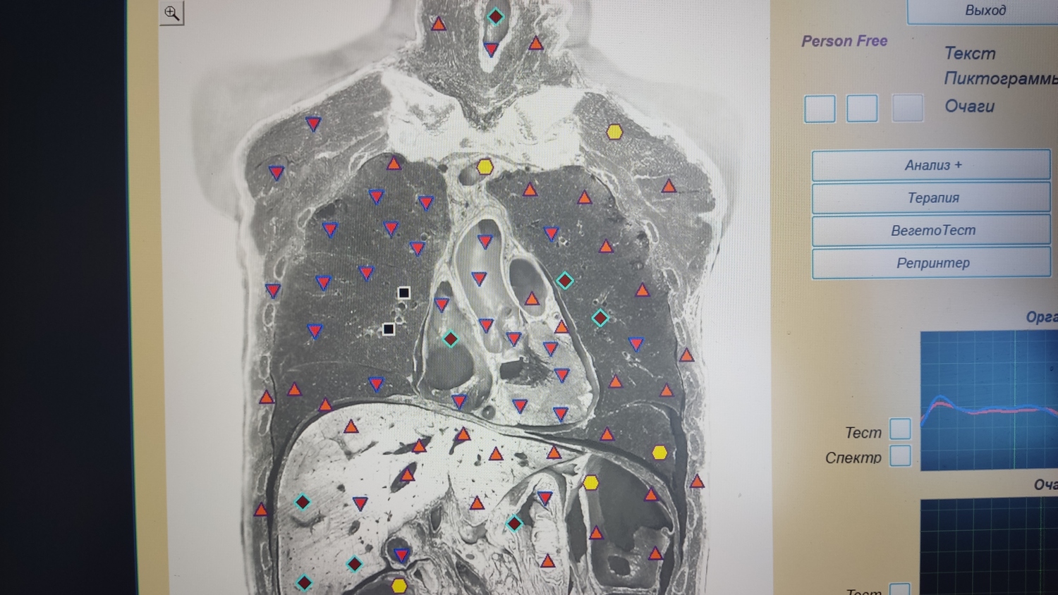 Определяем точно причину